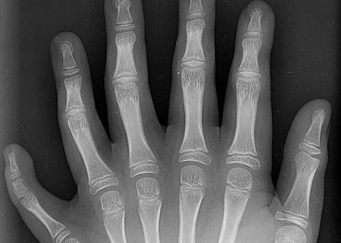 “It’s A Sight I’ll Never Forget”: 50 Unique Physical Features That Fascinated People