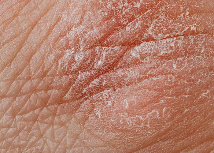 “It’s A Sight I’ll Never Forget”: 50 Unique Physical Features That Fascinated People