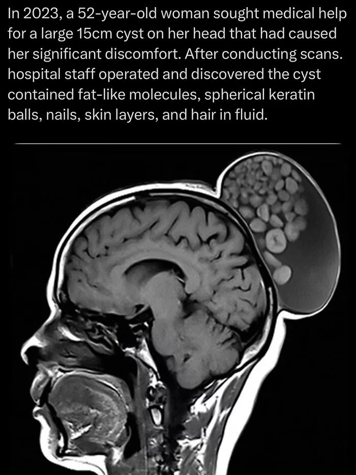 30 Unsettling Facts That Are So Creepy They Might Make You Close The Tab Immediately