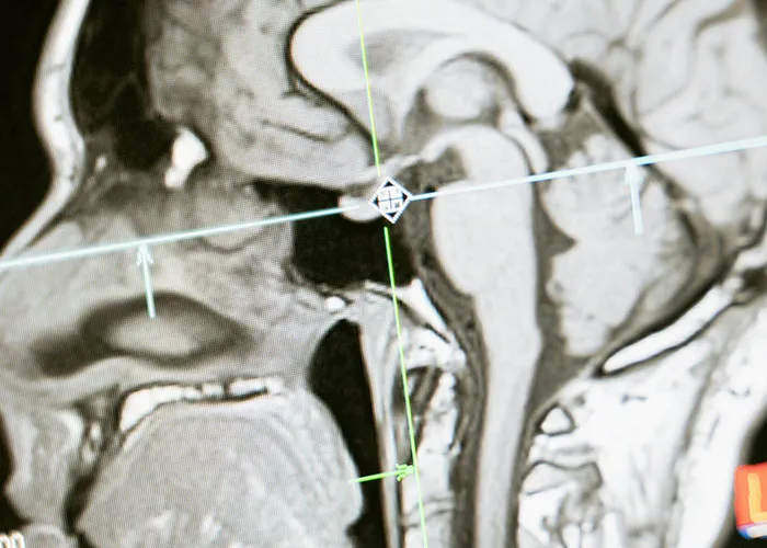 “It’s A Sight I’ll Never Forget”: 50 Unique Physical Features That Fascinated People
