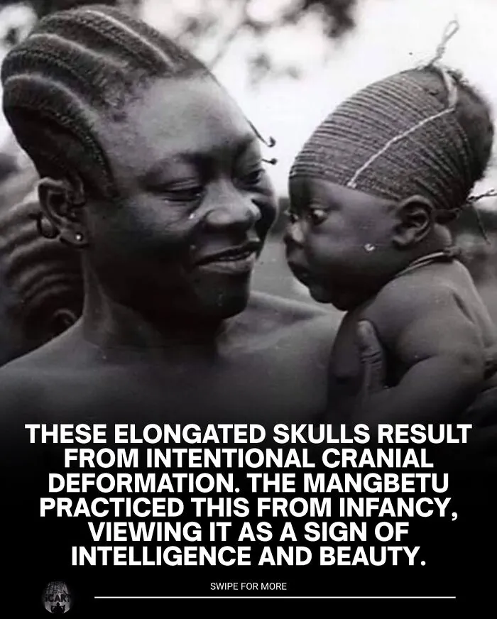 Black and white photo showing intentional cranial deformation practiced by Mangbetu, relating to scary bones facts for sleep loss.
