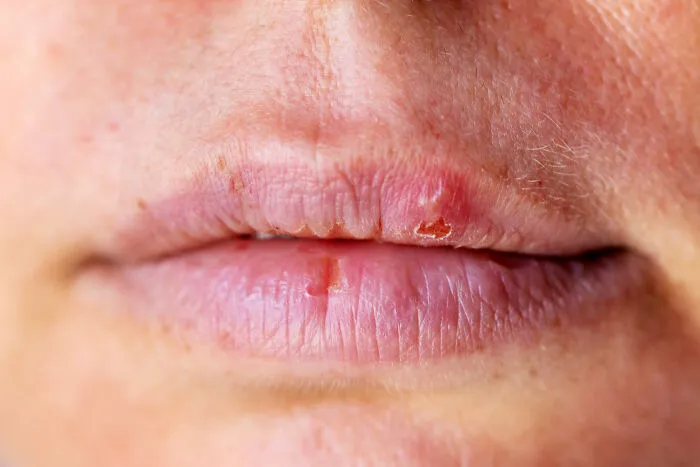 “My Mom Went To The ER For Dirt On Her Forehead”: 35 Of The Funniest ER Visits