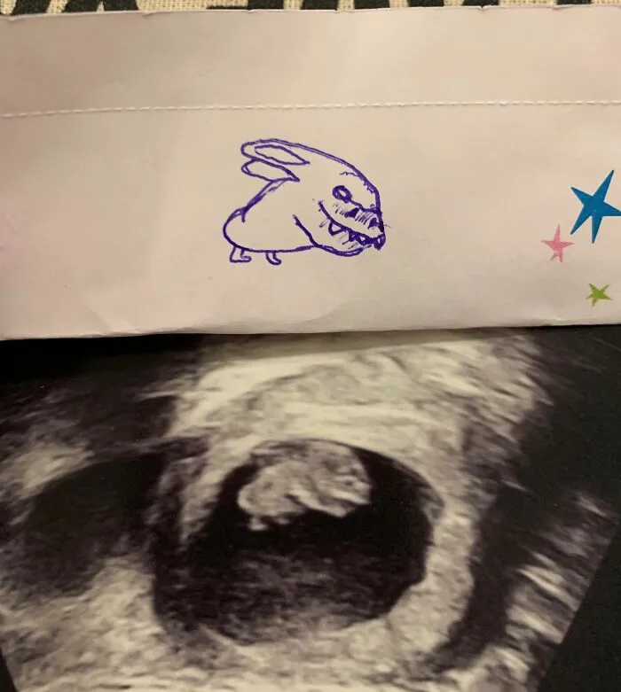 I Found Out I’m Going To Be An Uncle! My Sister Wasn’t Too Happy About My Interpretation Of Her Upside Down Ultrasound