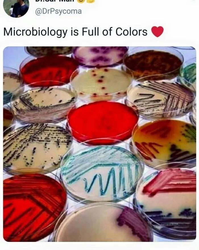 Petri dishes with various colorful bacterial cultures illustrating humor in healthcare memes about microbiology.