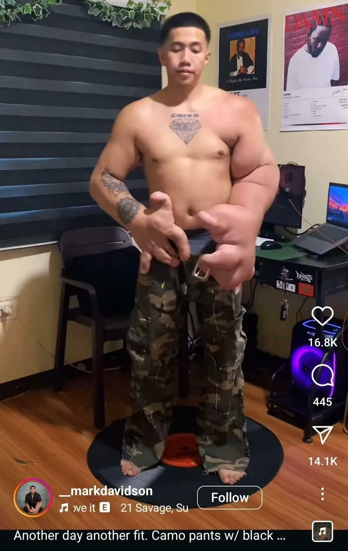 Can Someone Explain What May Have Caused This Gentleman's Arms To Grow In This Manner?