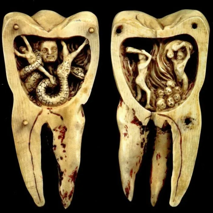 La gente solía creer que las caries eran causadas por demonios que perforaban los dientes.