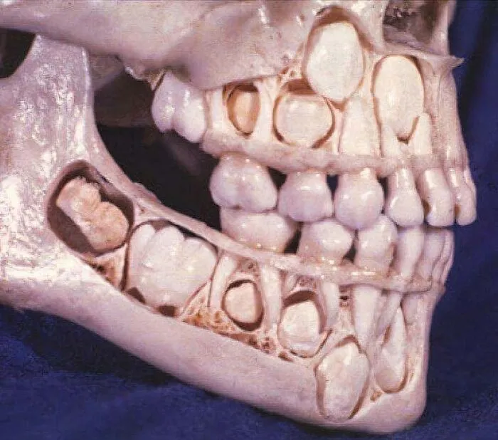 50 Medical Pics That Are Weirdly Mesmerizing And Slightly Disturbing
