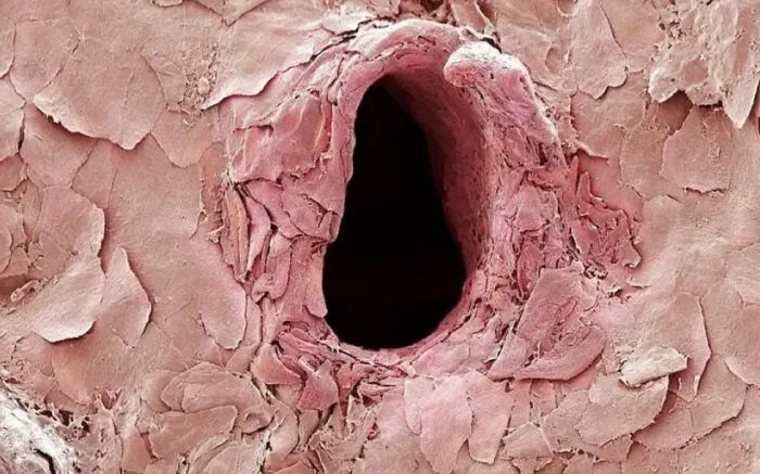 50 Medical Pics That Are Weirdly Mesmerizing And Slightly Disturbing