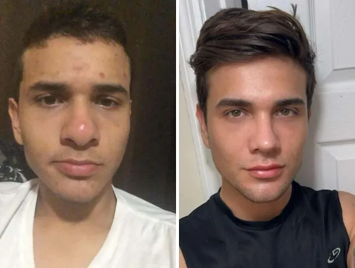 Antes y después