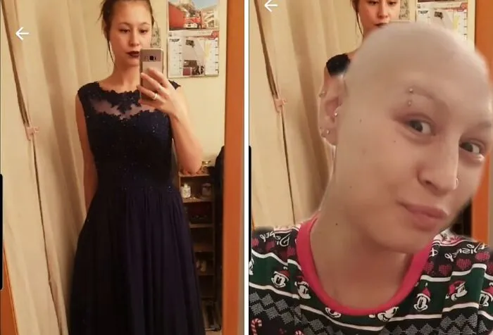67 People Who ‘Peaked’ Earlier In Life Share Their “Glow-Down” Before-And-After Pics