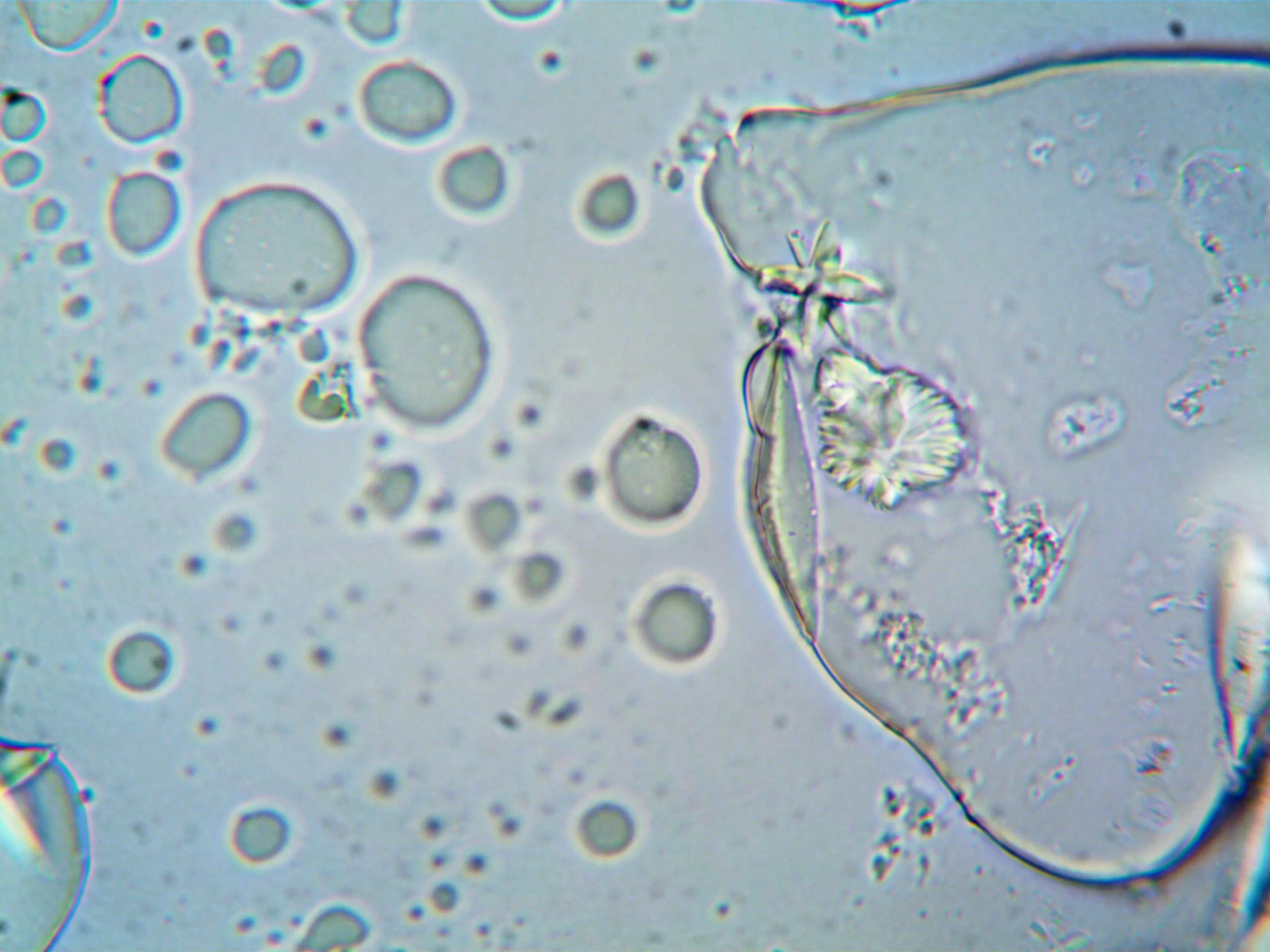 Microscopic view of cells engulfing large particles, illustrating the process by which a cell engulfs particles phagocytosis.