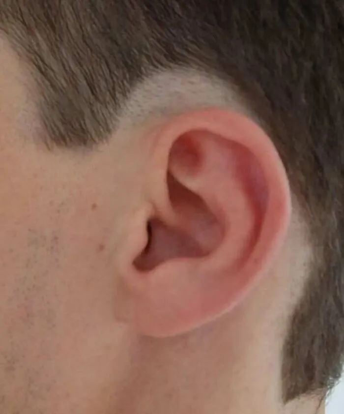 A close-up of an ear with a faded temple and an unfortunate haircut.