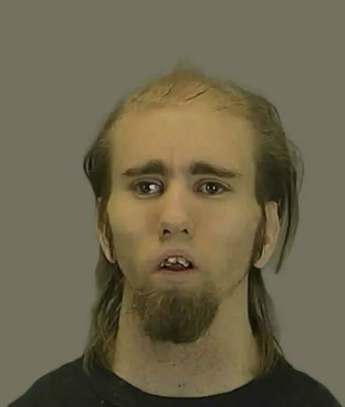 A man with an unfortunate haircut, long sideburns, a goatee, and a startled expression.