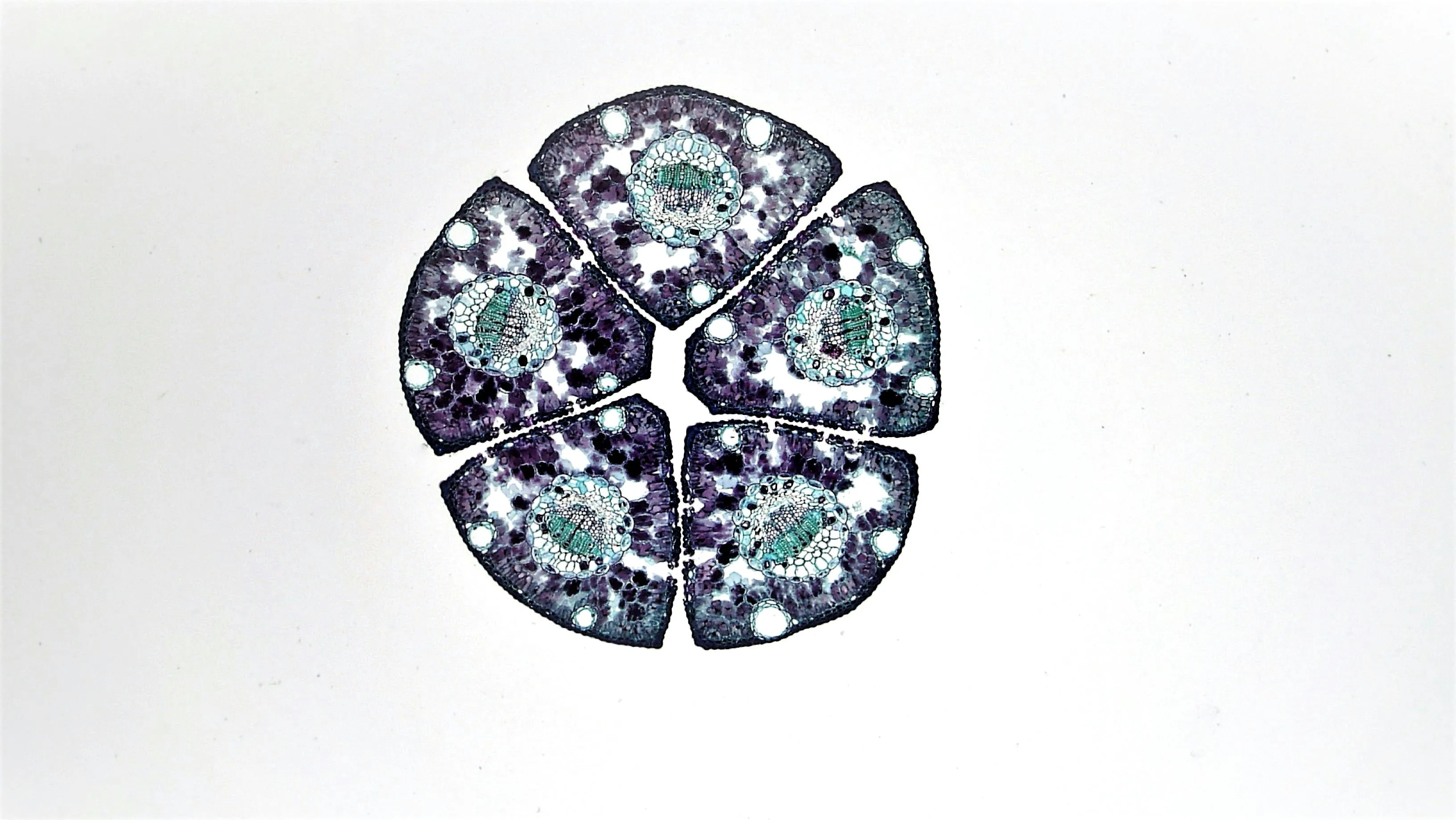 Microscopic cross section of plant cells showing cell walls and internal structures controlling what enters and leaves cells.