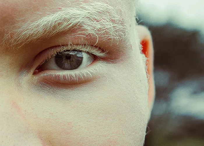 “It’s A Sight I’ll Never Forget”: 50 Unique Physical Features That Fascinated People