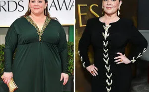 “She Needs Help”: Fan Frenzy Over Botched Plastic Surgery And Weight Loss After The Golden Globes