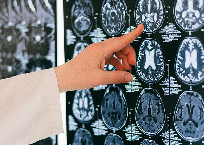 20 Pacientes cuentan lo peor que les han dicho los médicos