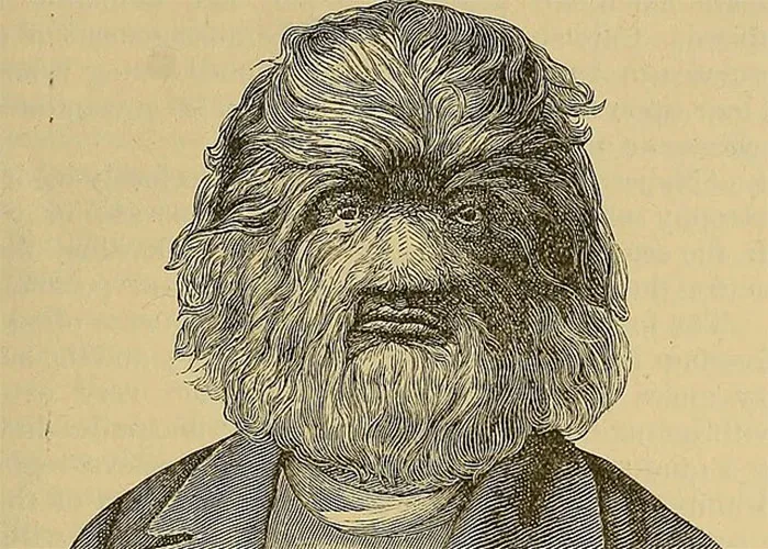“It’s A Sight I’ll Never Forget”: 50 Unique Physical Features That Fascinated People