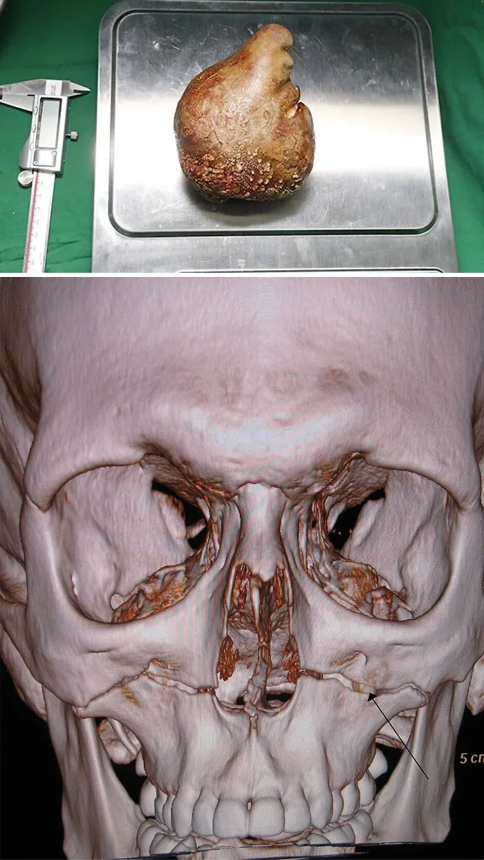 46 Medical Facts So Unusual Most People Never Learn Them