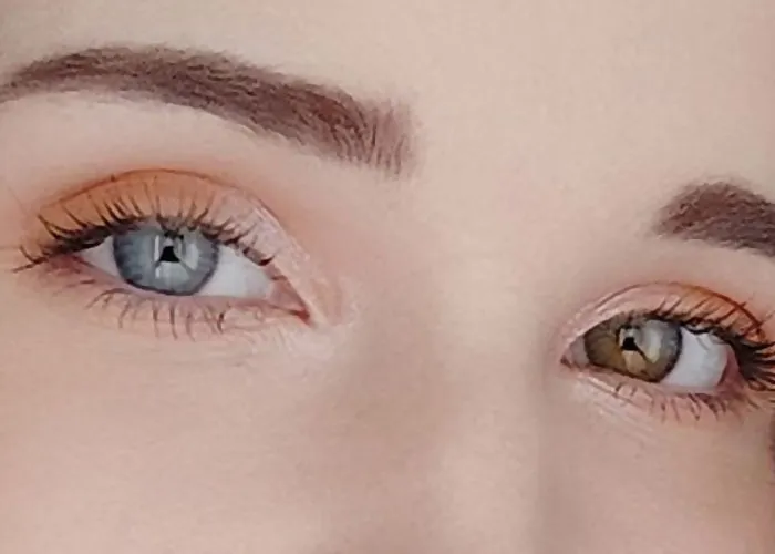 “It’s A Sight I’ll Never Forget”: 50 Unique Physical Features That Fascinated People