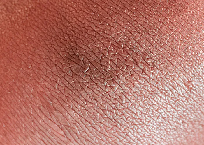 Close-up of rare physiological skin traits showing unique texture and patterns not commonly seen in most people.