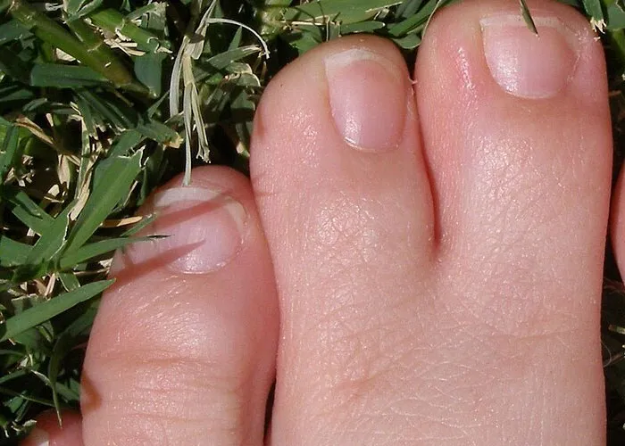“It’s A Sight I’ll Never Forget”: 50 Unique Physical Features That Fascinated People