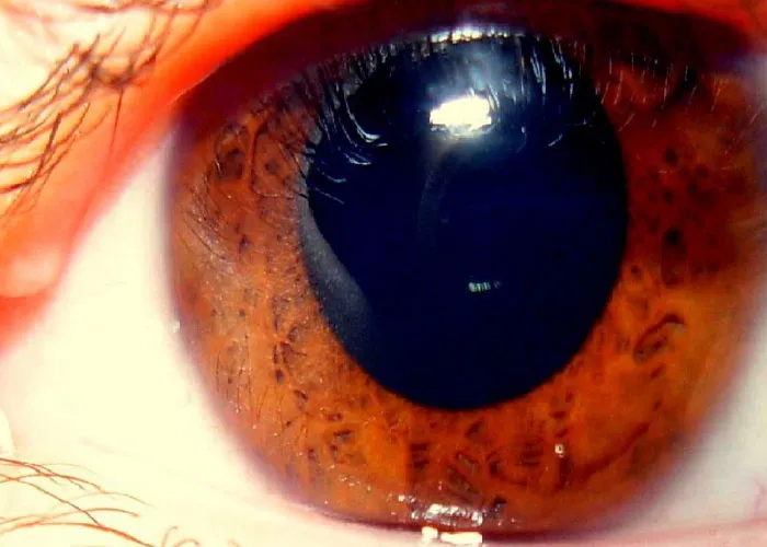 “It’s A Sight I’ll Never Forget”: 50 Unique Physical Features That Fascinated People