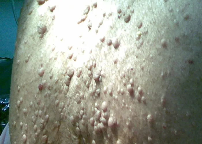 “It’s A Sight I’ll Never Forget”: 50 Unique Physical Features That Fascinated People