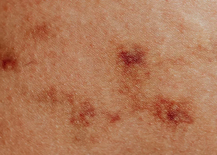 “It’s A Sight I’ll Never Forget”: 50 Unique Physical Features That Fascinated People