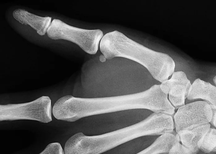 “It’s A Sight I’ll Never Forget”: 50 Unique Physical Features That Fascinated People