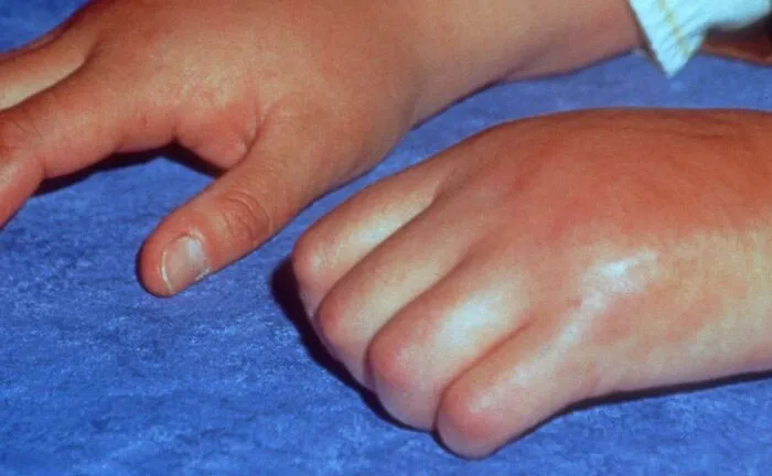 38 Diseases That Are The Worst Of The Worst