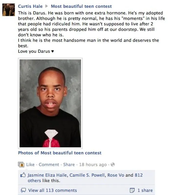 Facebook post about a teen with a unique condition, an example from internet photos that weren’t what they seemed.