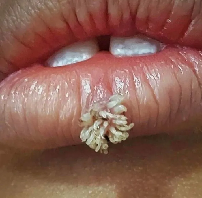 50 Medical Pics That Are Weirdly Mesmerizing And Slightly Disturbing