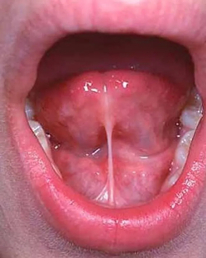 30 Imágenes médicas extrañamente fascinantes y un poco perturbadoras