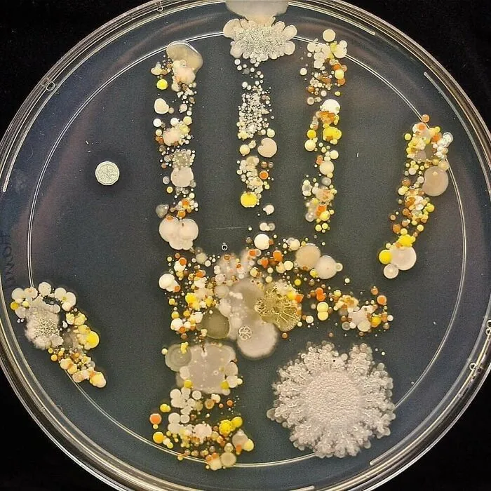 50 Medical Pics That Are Weirdly Mesmerizing And Slightly Disturbing