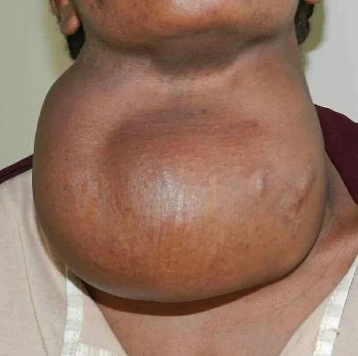 50 Medical Pics That Are Weirdly Mesmerizing And Slightly Disturbing