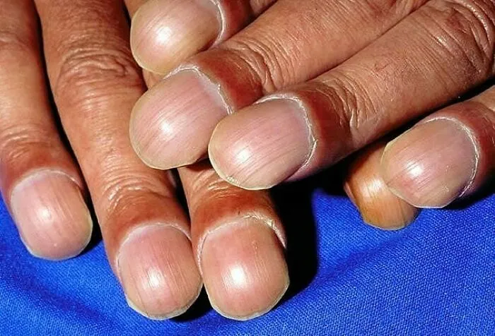 30 Imágenes médicas extrañamente fascinantes y un poco perturbadoras