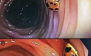 50 Medical Pics That Are Weirdly Mesmerizing And Slightly Disturbing