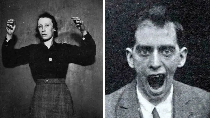 There Was A Disease That Left People Awake But Unable To Move Or Speak. Many Were Trapped Inside Their Own Bodies, And It Vanished Without Anyone Ever Understanding Why