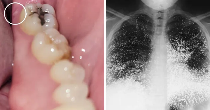 57 Fascinating And Unnerving Medical Photos Not Everyone Can Handle (New Pics)