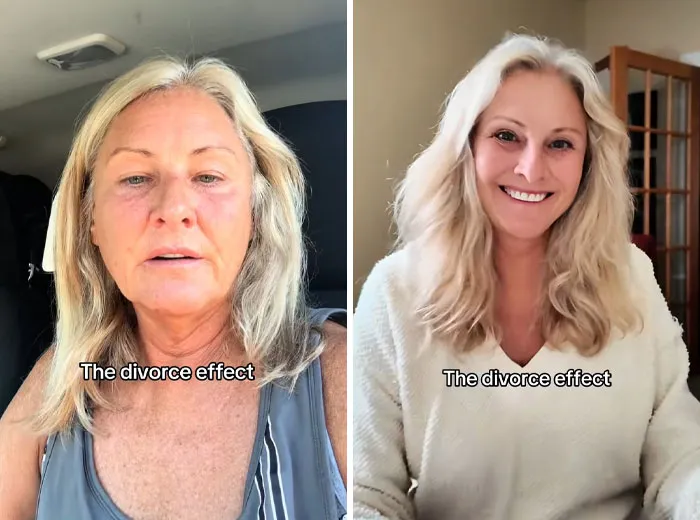 “El efecto divorcio”: 40 Fotos de antes y después de personas que se divorciaron y les sentó genial