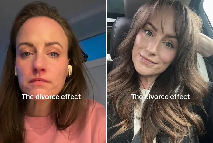 Mujer mostrando el efecto del divorcio en fotos de antes y después, reflejando cambios positivos y bienestar personal.