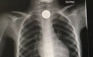 32 Accidentes y errores tan caros que duele verlos