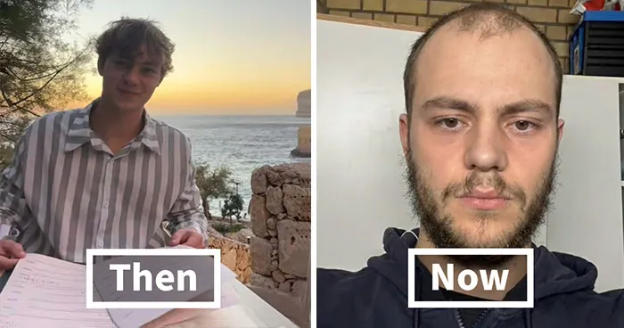 67 People Who ‘Peaked’ Earlier In Life Share Their “Glow-Down” Before-And-After Pics