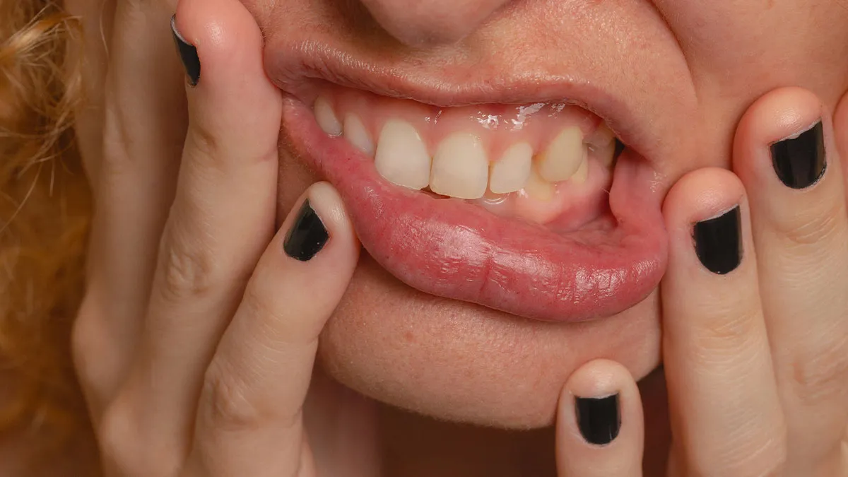 57 Things Women Did To Their Bodies As Teens Because Beauty Standards Said They Should