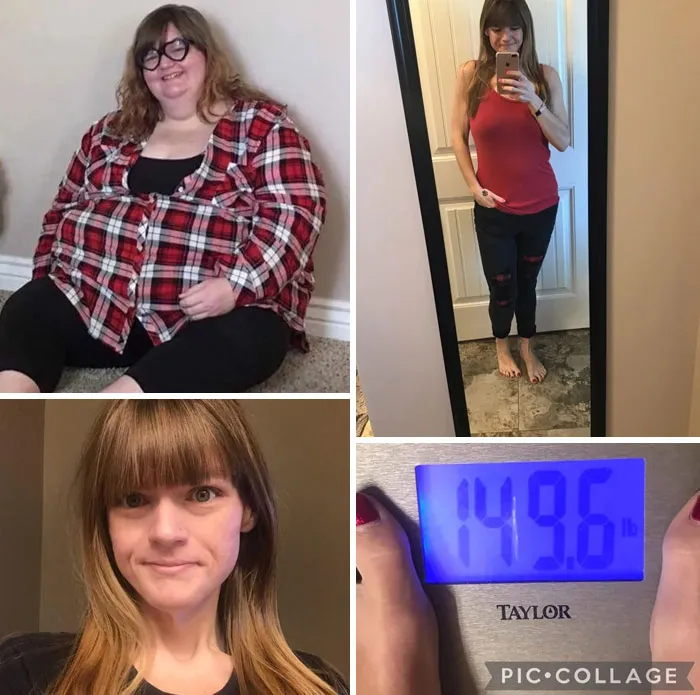 The Ones Seen In /R/Progresspics And /R/Loseit Are Super Inspiring, Especially People Who Have Lost Over 200-300 Lbs