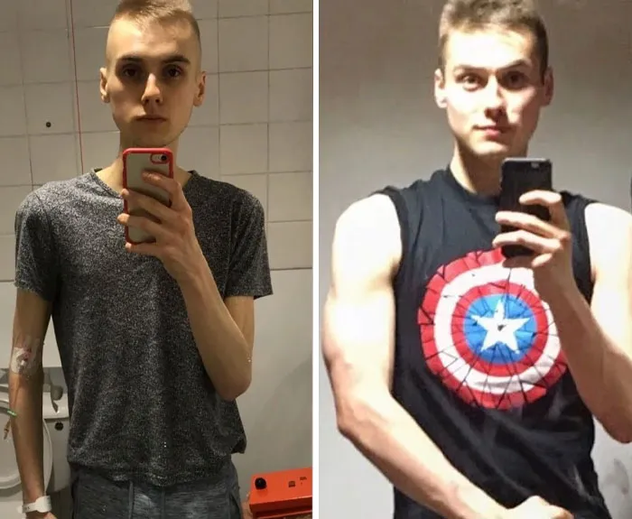 M/22/5'11" [99lbs > 150lbs = 51lbs] Anorexia My Recovery