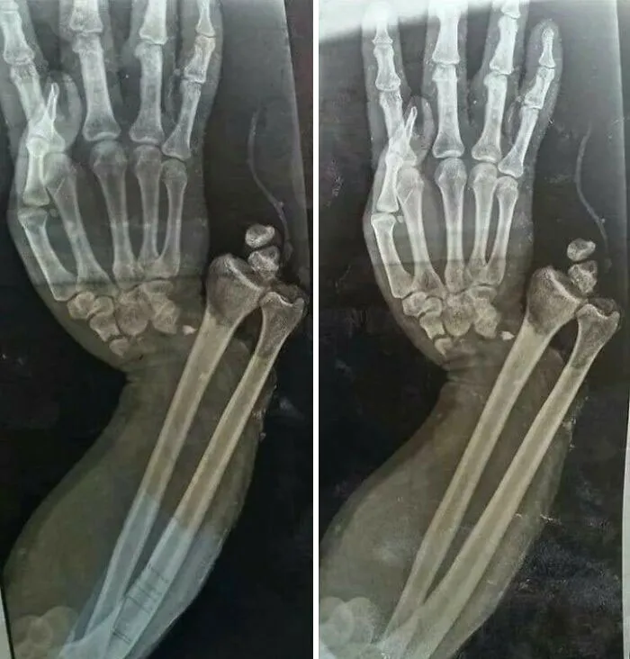 50 Medical Pics That Are Weirdly Mesmerizing And Slightly Disturbing