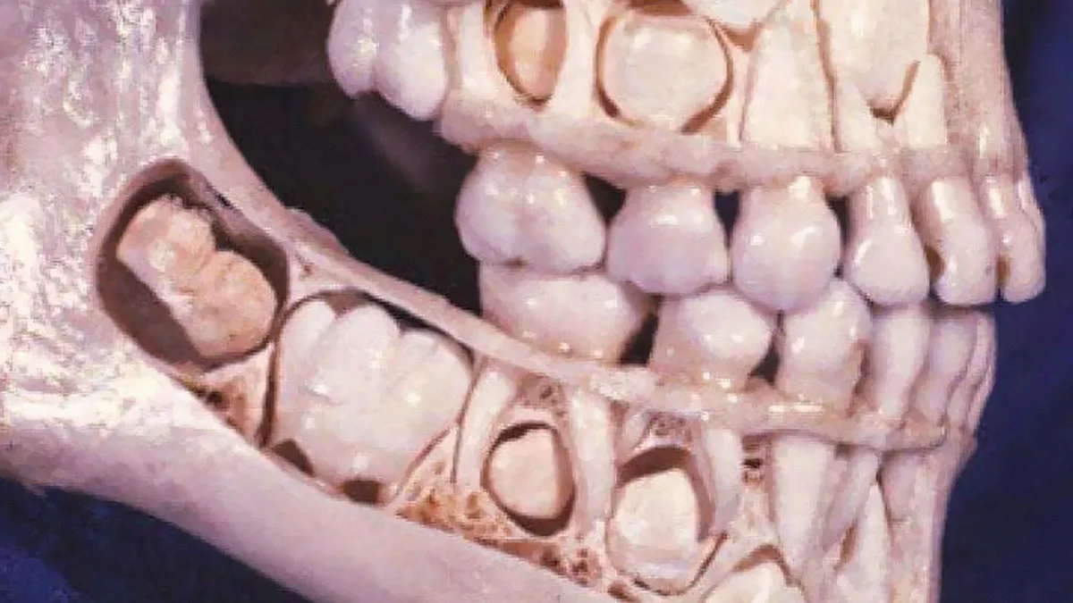 50 Medical Pics That Are Weirdly Mesmerizing And Slightly Disturbing
