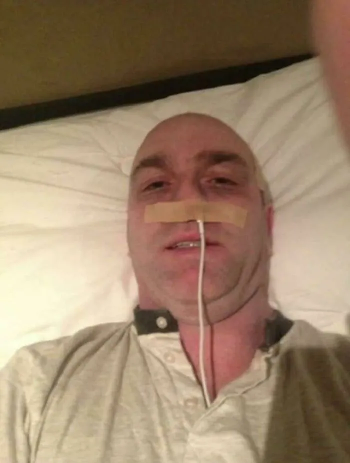 Man lying in bed with tape on his face and a wire hanging from his nose, part of funny local inside jokes shared online.